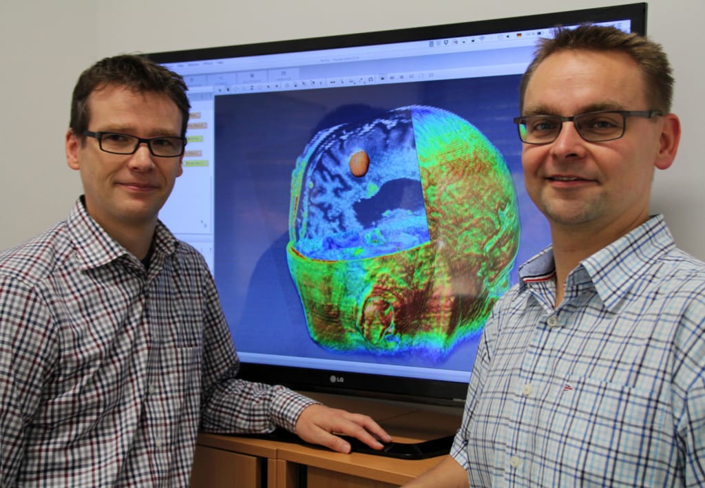 Das Forschungsprojekt „GliomaMIC“ von Prof. Dr. Christoph Palm von der OTH Regensburg (links) und Dr. med Markus Hutterer (rechts) vom Universitätsklinikum  Regensburg soll dazu beitragen Hirntumore besser beurteilen zu können, um damit die Behandlung der Erkrankten zu verbessern. Foto: OTH Regensburg